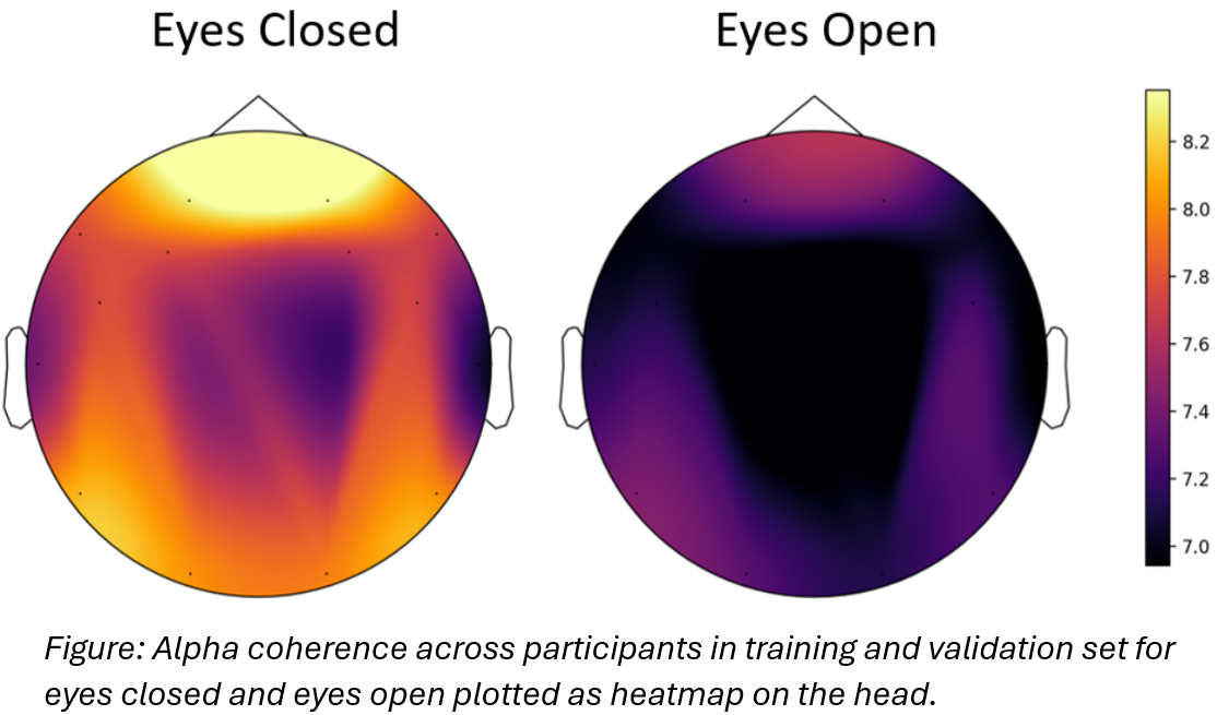 EEG Figure